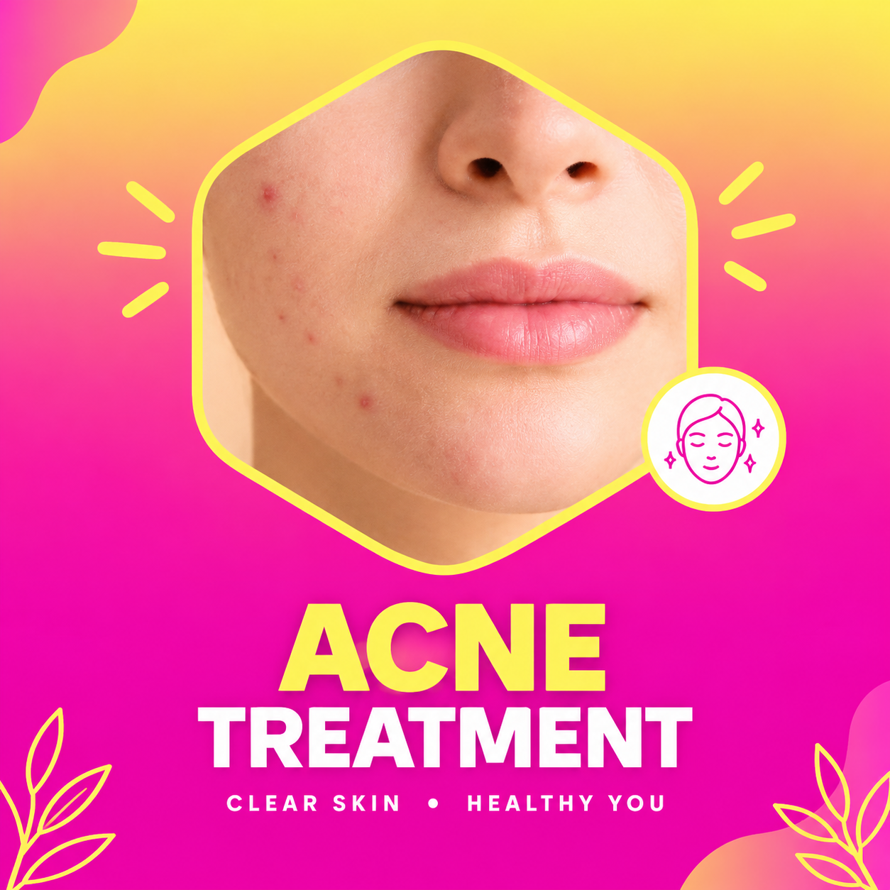 Acne Care